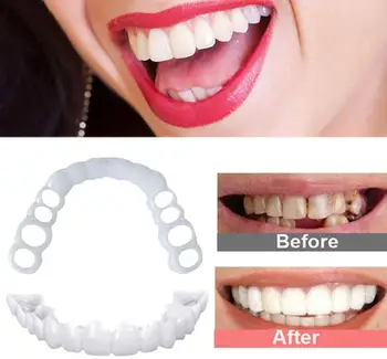 Kot nalašč Primerna za Beljenje Zob Ponaredek Zob Kritje Pripni Na Silikonski Nasmeh Luske Zob Zgornji Lepoto Orodje Kozmetični Zob 2Pcs
