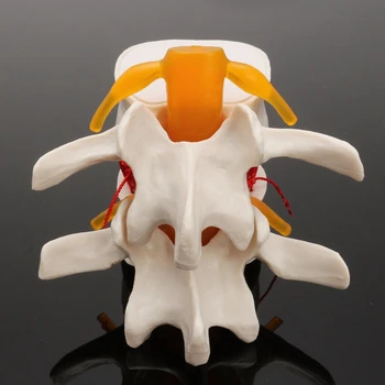 Človeška Anatomija Kosti Hrbtenice, Ledveni Disk Herniation Poučevanja Model Možganov, Lobanje Travmatičnih Šolske Potrebščine Instrume 27173