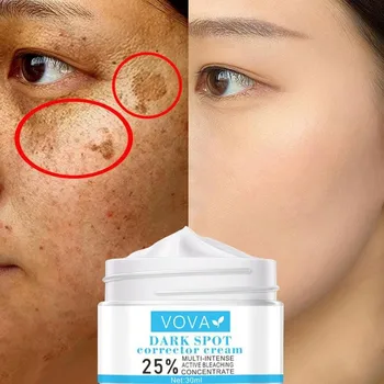 Učinkovito Beljenje Freckle Kremo Odstranite Melasma Acne Spot Pigment Melanin Temne Lise Pigmentacije Vlažilni Gel Za Nego Kože