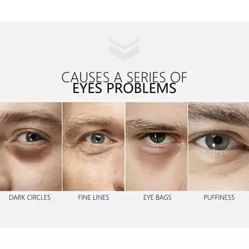 Polipeptidne Moške Dan Noč Eye Cream Vlažilna Krogih Temno Fine Oči Linijo za Nego Vrečko Odstranitev Oči Proti Zabuhlost K2P6